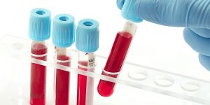 Blood Tests Everyone Should Have After 35