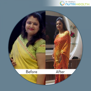 Dr Shikha’s Nutrihealth Review : In 4 month, lost 18 kgs weight